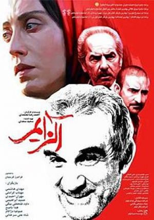 آلزایمر